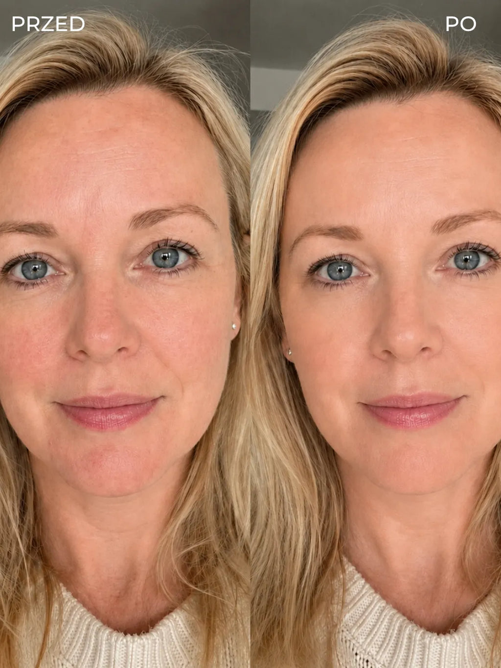 Changing Foundation